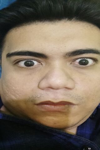 Surprised Expression 😲