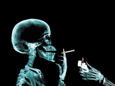 SMOKING X-RAY