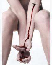 Red strea