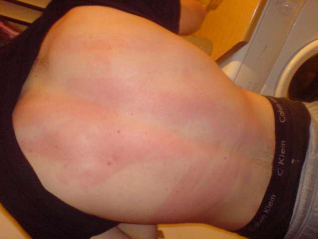 beau afte