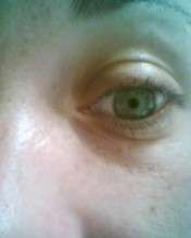 My eye v2.0