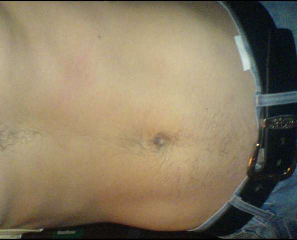 Pic.. Me gut lol