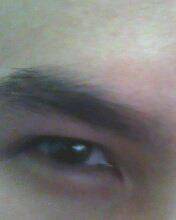 my eye