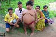 World fat
