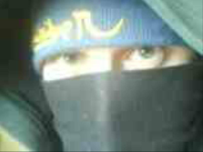 green eye