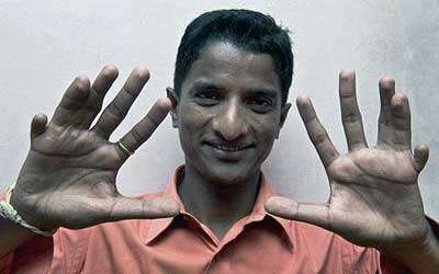 12 finger