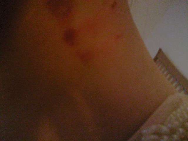Aftermath