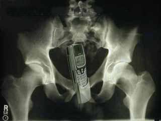 x-ray