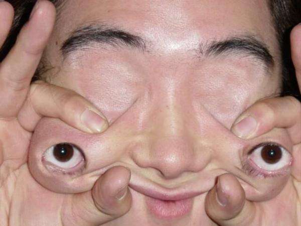 Eyes Relocated