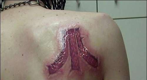 tAttoo on