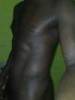 atmyback