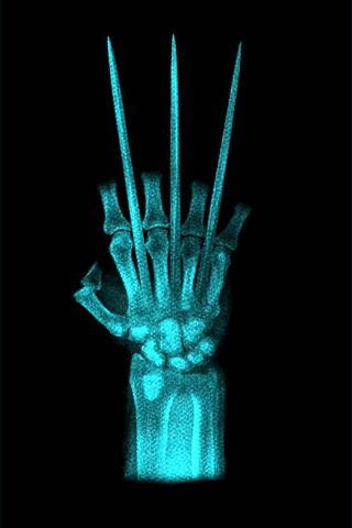 Wolverine Claw X-Ray